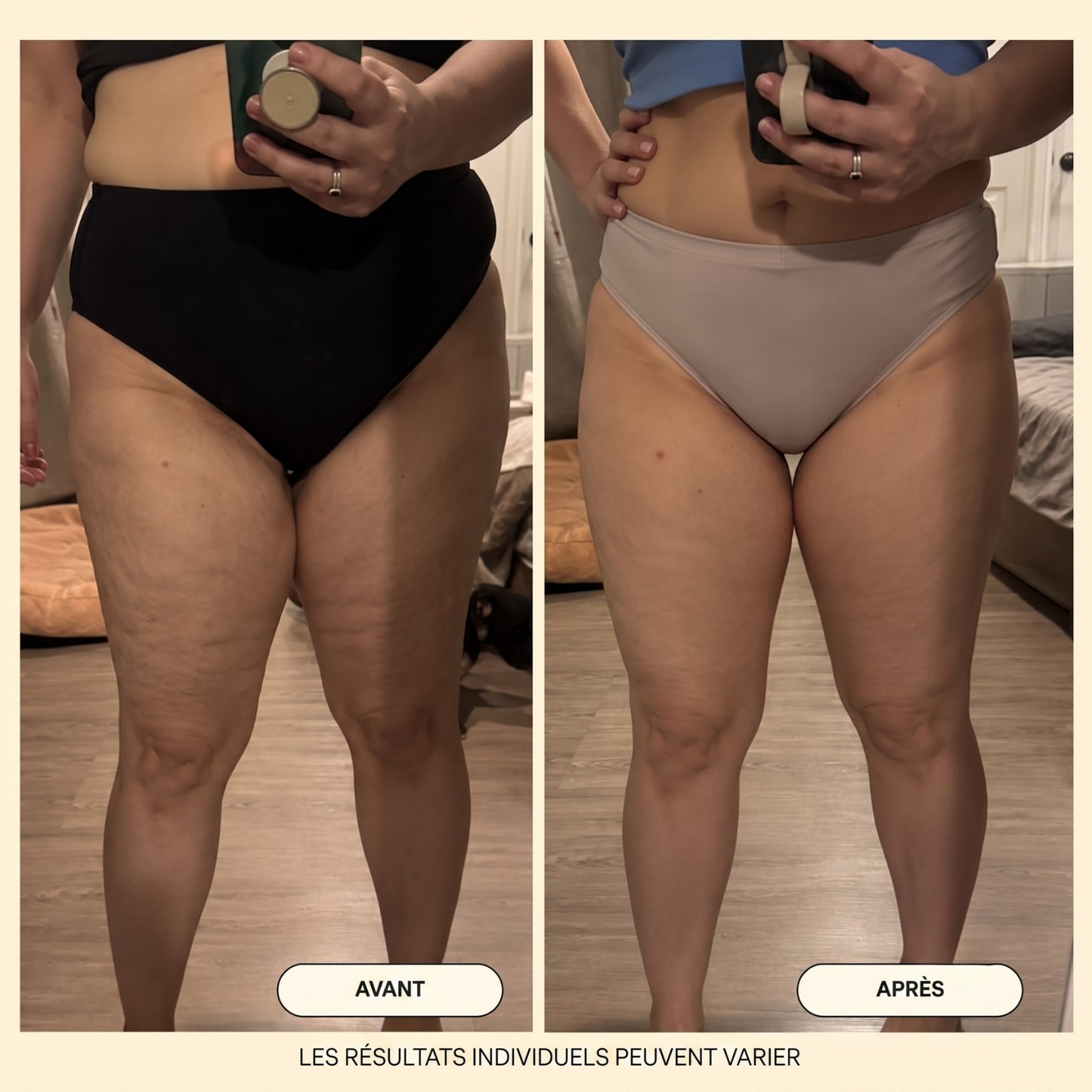Huile de massage anti-cellulite Velqoria