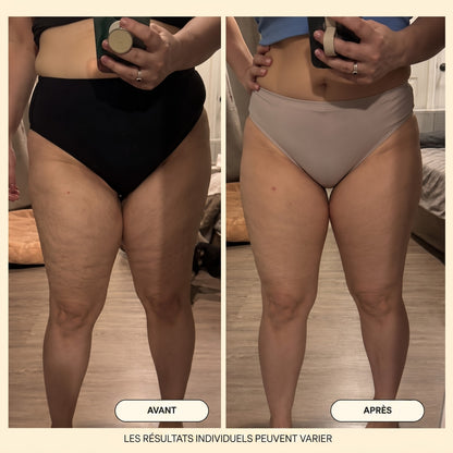 Huile de massage anti-cellulite Velqoria