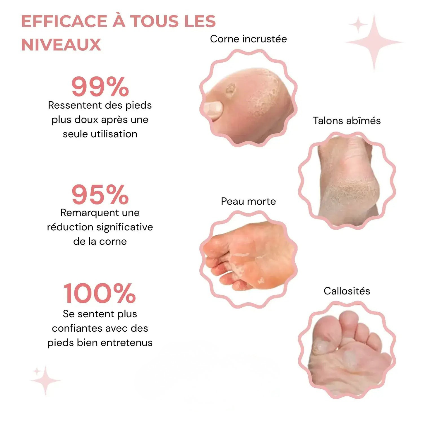 Velqoria™ - Kit Beauté Pieds