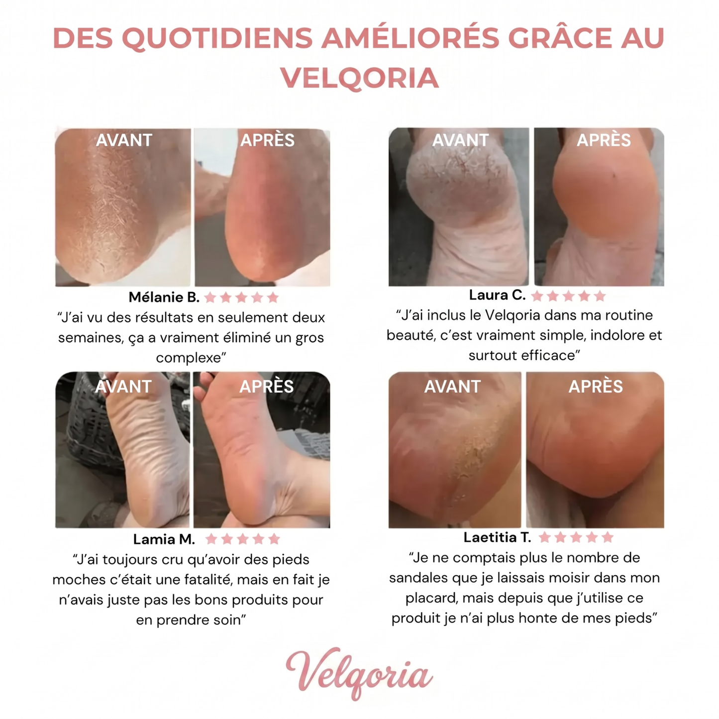 Velqoria™ - Kit Beauté Pieds