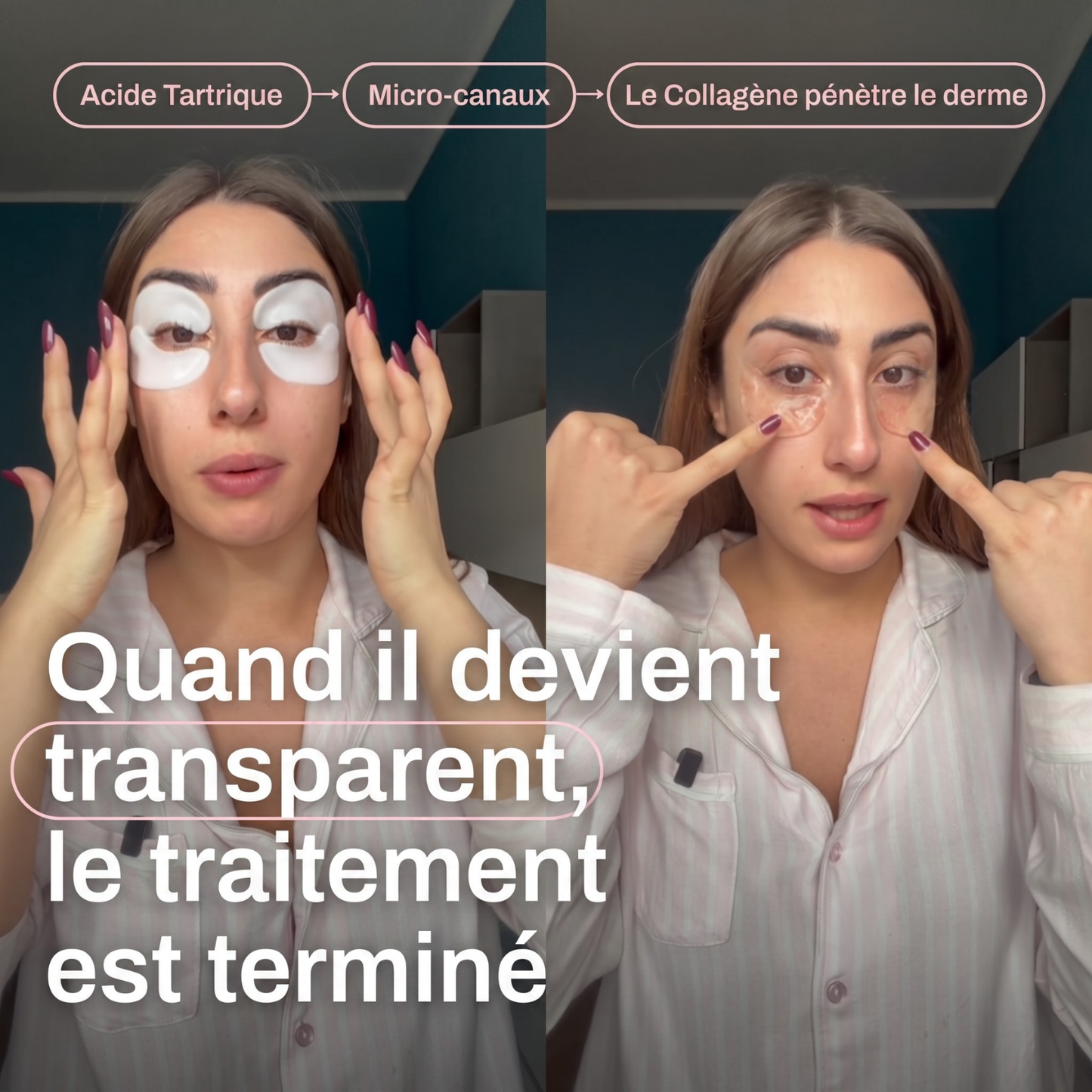 Patch Effet Lifting – Velqoria