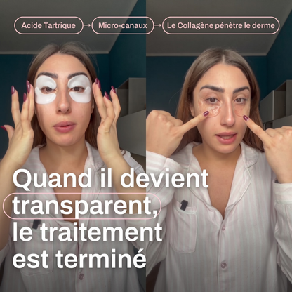 Patch Effet Lifting – Velqoria