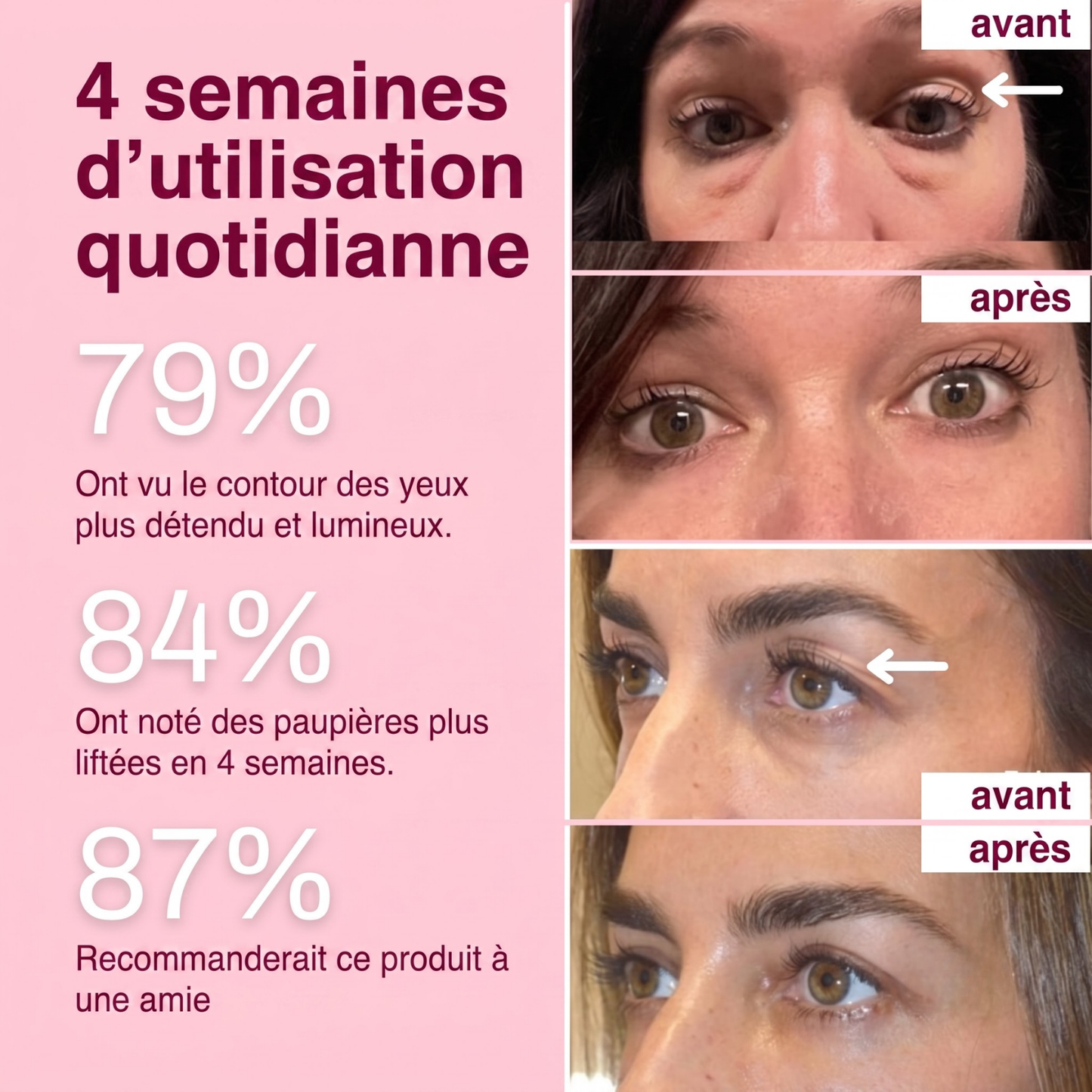 Patch Effet Lifting – Velqoria