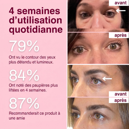 Patch Effet Lifting – Velqoria
