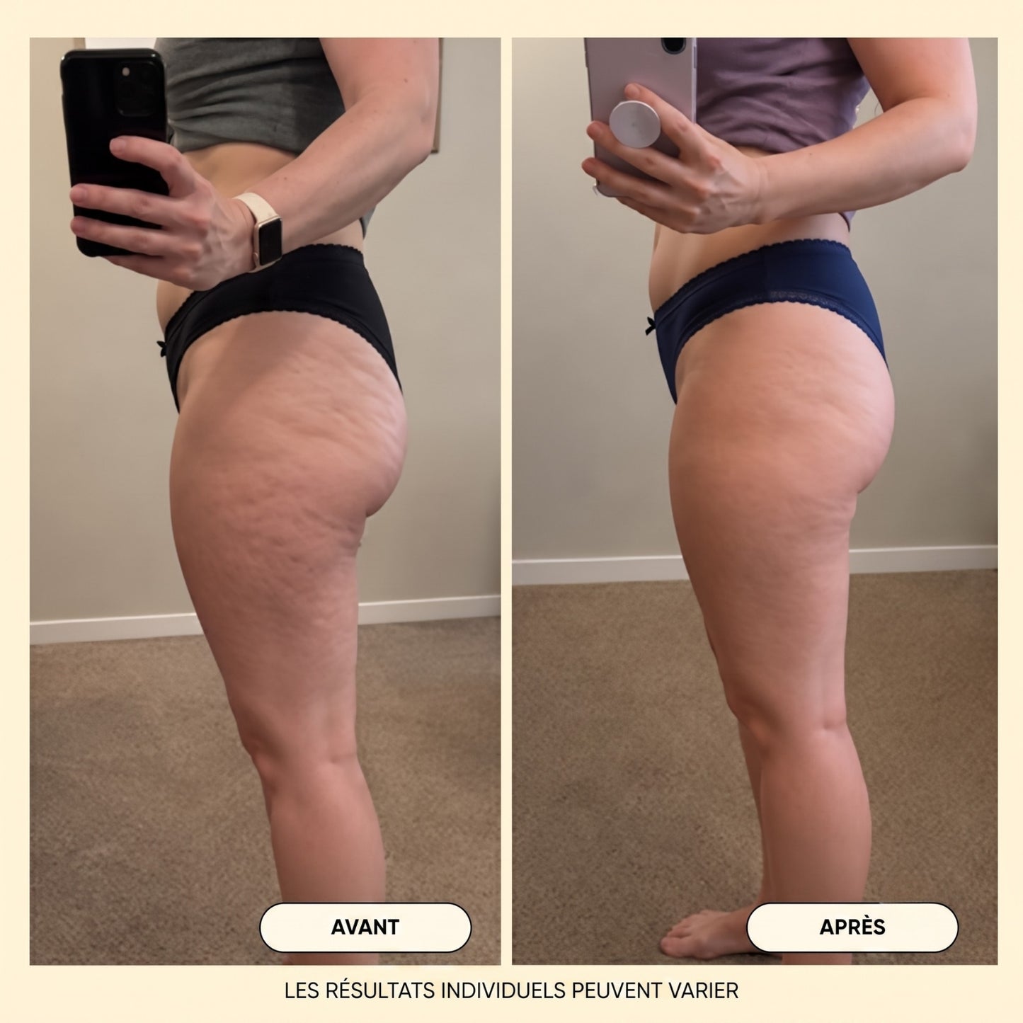 Huile de massage anti-cellulite Velqoria