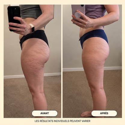 Huile de massage anti-cellulite Velqoria