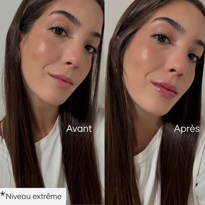 Repulpeur de lèvres
