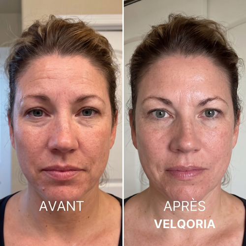 Avant après