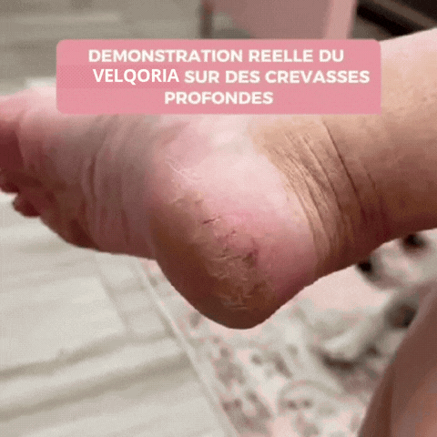 Velqoria™ - Kit Beauté Pieds